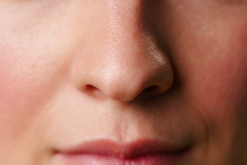 What Are the Most Common Causes of Nosebleeds?